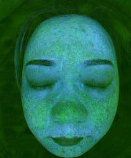 Rosto feminino sob luz UV composta, em tons de verde, com a distribuição de sebo em destaque