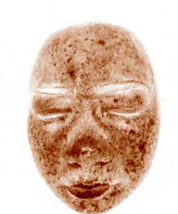 Rosto feminino no mapa de melanina, em marrom, com as manchas pigmentadas em destaque