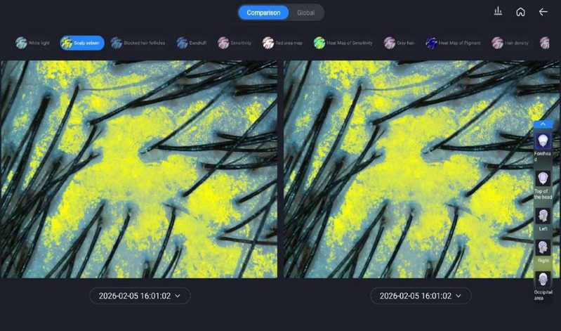 Tela do software com duas imagens de couro cabeludo lado a lado, cada uma com data e hora